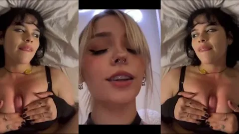 very lackluster braces pmv